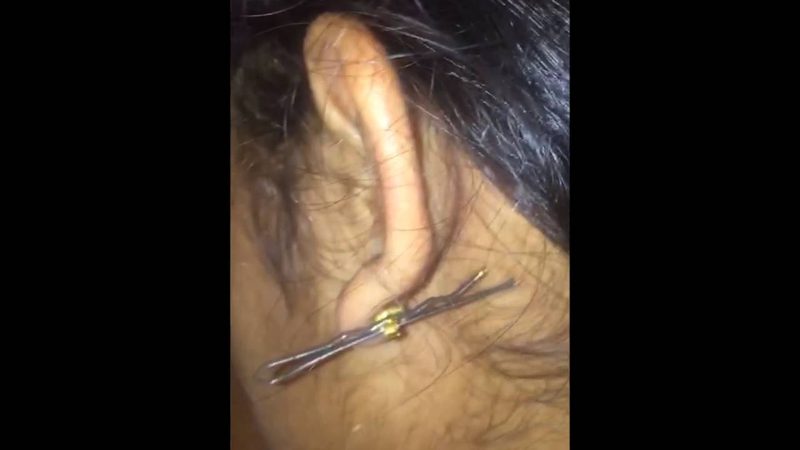 网站重做，定制开发如何选？揭秘关键因素